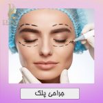 جراحی پلک در اصفهان