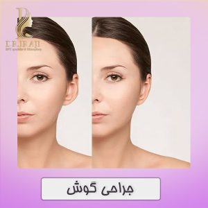 جراحی گوش در اصفهان - دکتر نیلوفر ایرجی