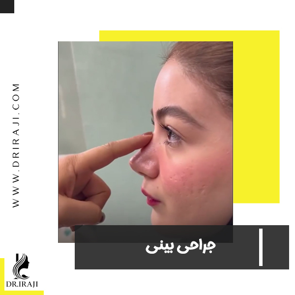 جراحی بینی - دکتر نیلوفر ایرجی