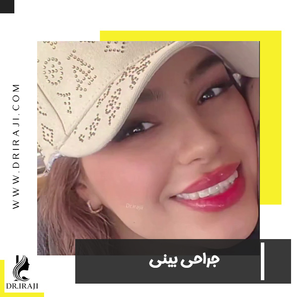 عکس عمل بینی