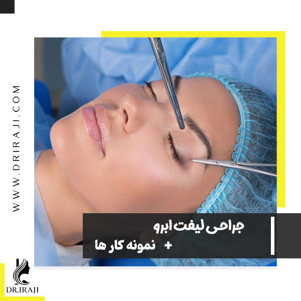 جراحی لیفت ابرو در اصفهان - دکتر ایرجی