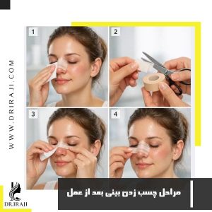 مراحل چسب زدن بینی بعد از عمل + مزایا استفاده از چسب بینی
