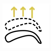 Endoscopic Brow Lift