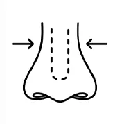 دکتر نیلوفر ایرجی - Rhinoplasty