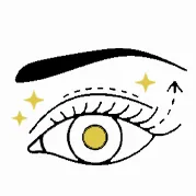 دکتر نیلوفر ایرجی - Upper Blepharoplasty