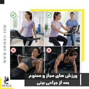 بهترین زمان برای ورزش بعد از جراحی بینی + ورزش های مجاز و ممنوع