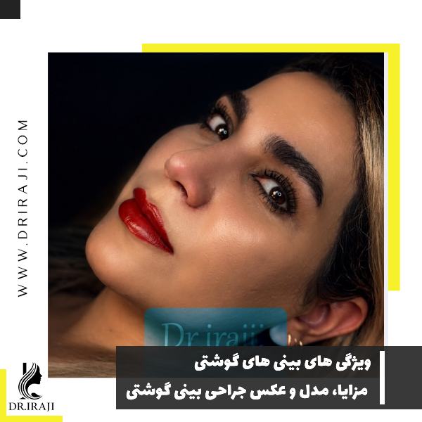 ویژگی های بینی های گوشتی + مزایا، مدل و عکس جراحی بینی گوشتی