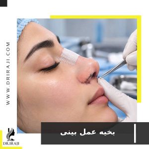 بخیه عمل بینی