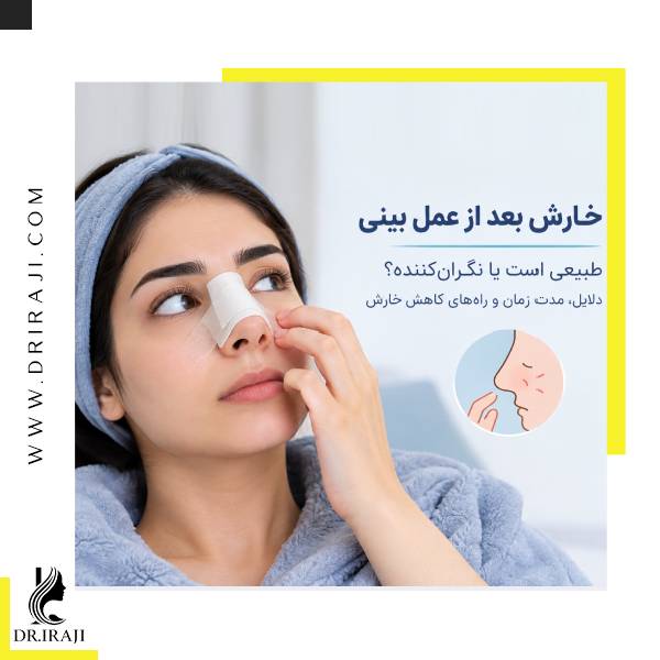 خارش بعد از عمل بینی