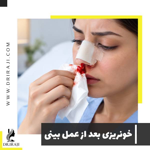 خونریزی بعد از عمل بینی