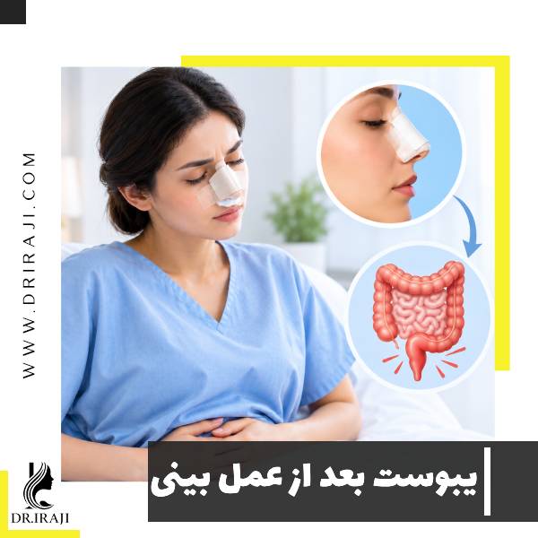 یبوست بعد از عمل بینی